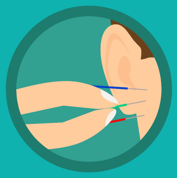 acupunture arlington heights il